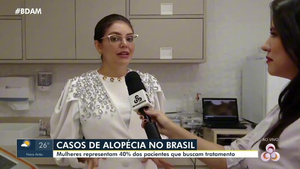 Casos de Alopecia no Brasil