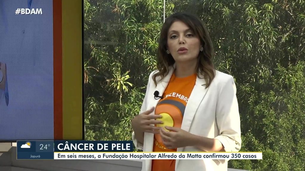 Casos de câncer de pele no Amazonas